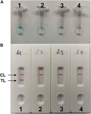 Establishment and application of loop-mediated isothermal amplification coupled with nanoparticle-based lateral flow biosensor (LAMP-LFB) for visual and rapid diagnosis of Candida albicans in clinical samples